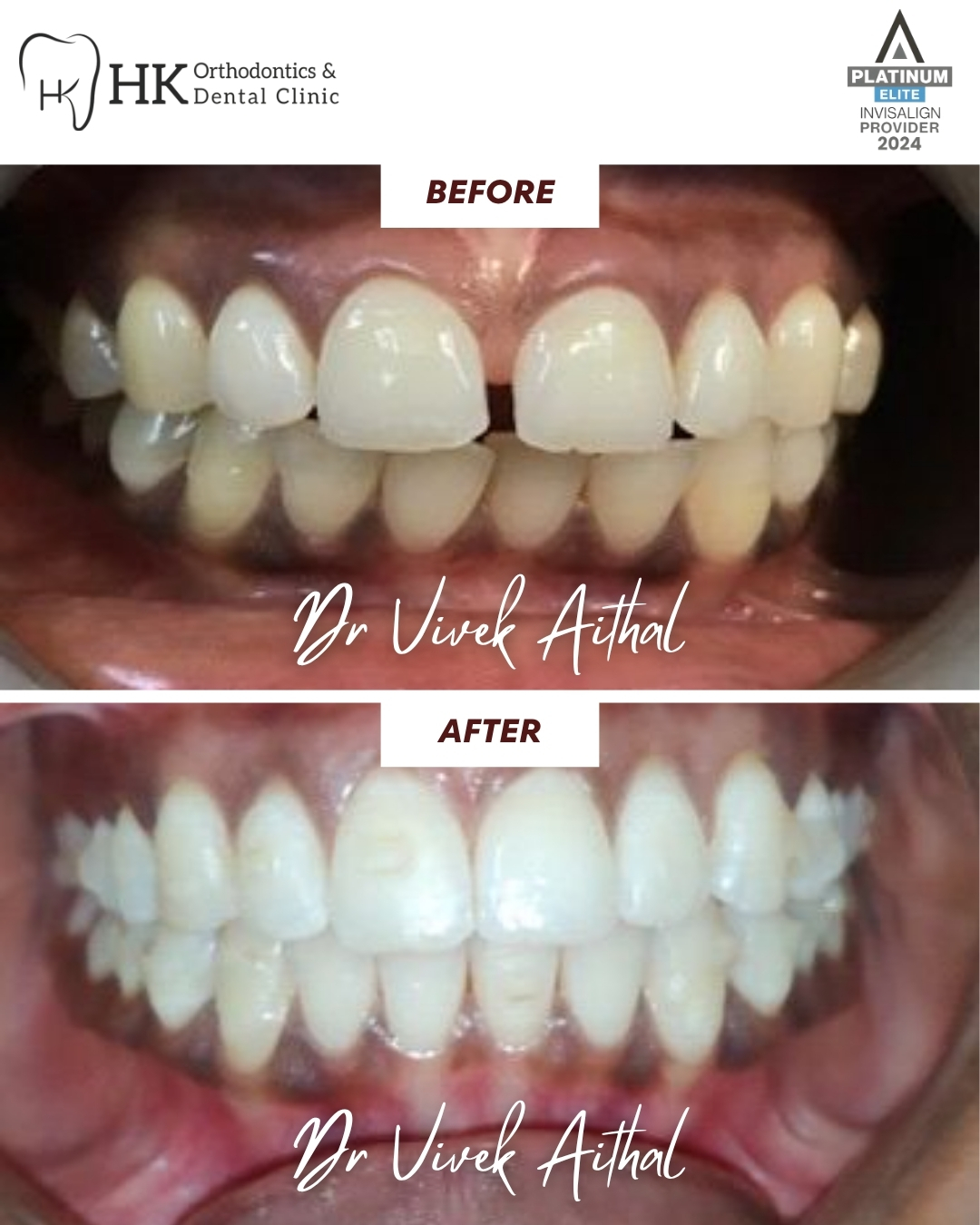 HK dental - 03 before after