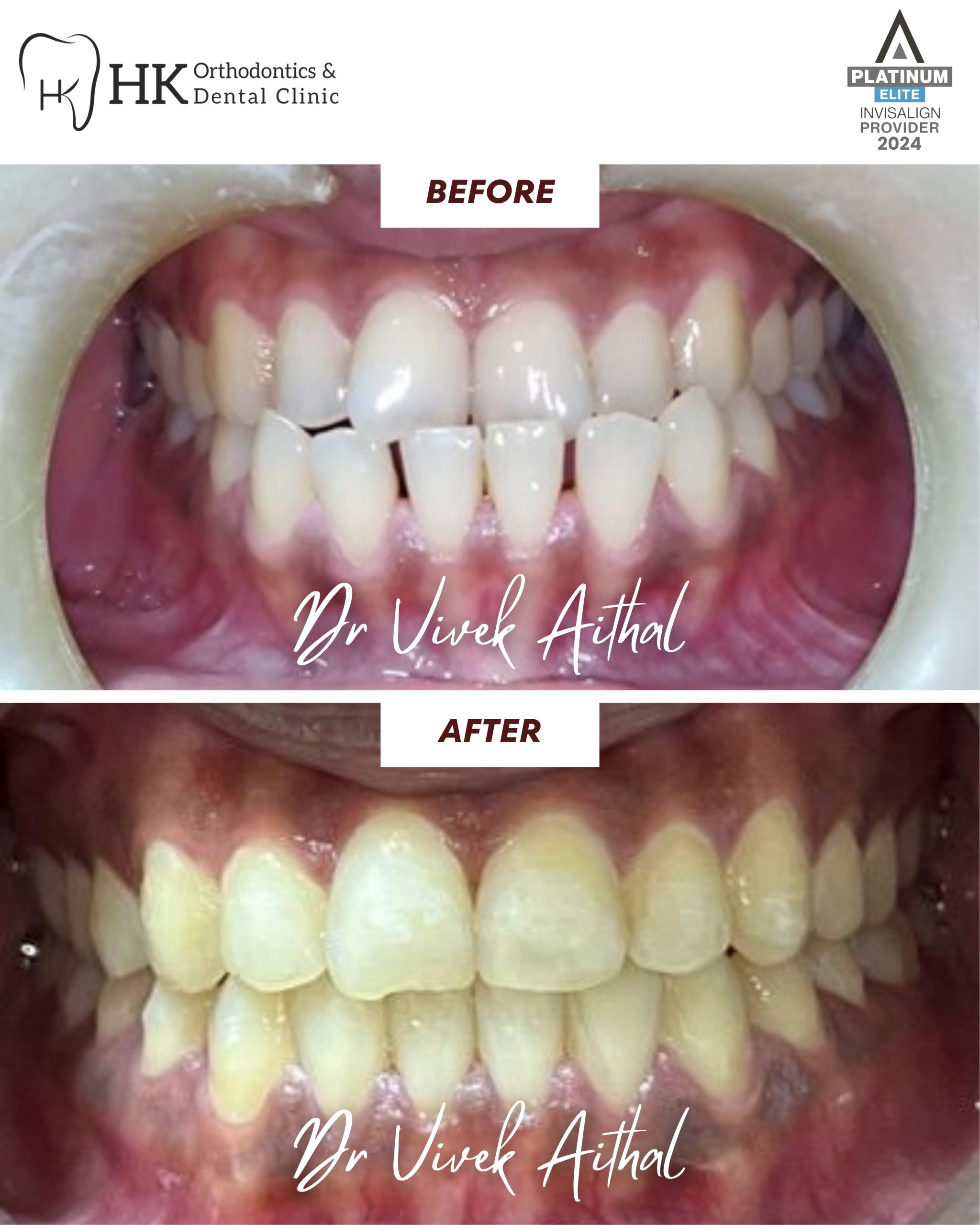 HK dental - 04 before after (1)