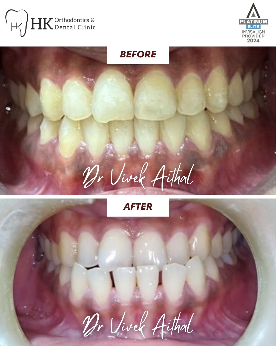 HK dental - 04 before after
