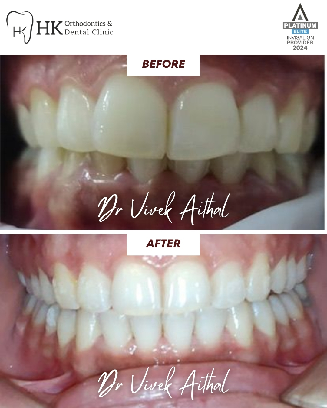 HK dental - 05 before after